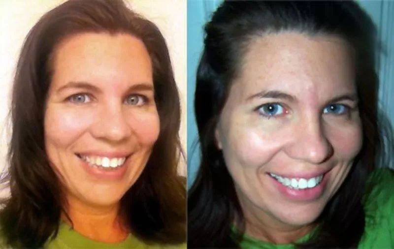 meaningful-beauty-before-after Meaningful Beauty Update