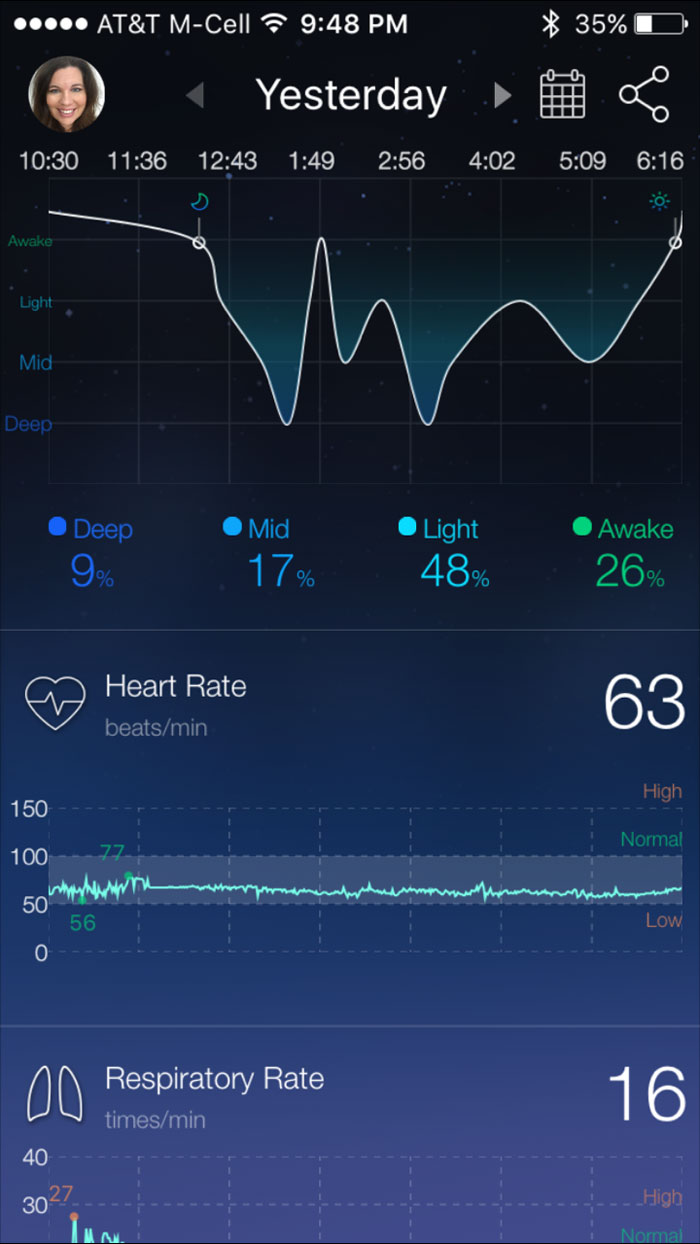 Sleep-Analysis-RestOn-Review-4