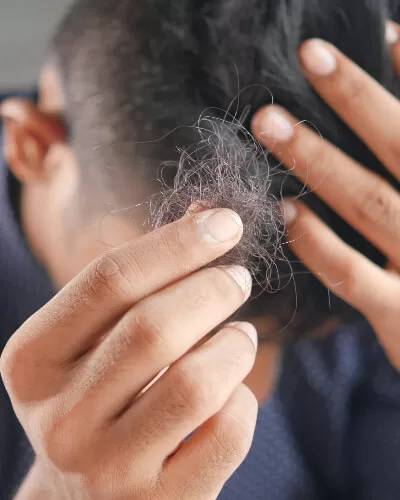 male hair thinning